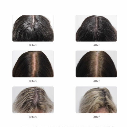 Larimide Kojaxin Stops Hair loss & Stimulates Growth Ampous (15 X 4ml)