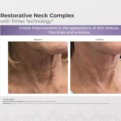 Alastin Skincare® Restorative Neck Complex with TriHex Technology® 50 mL